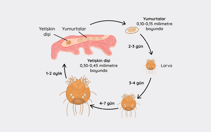 Uyuz Hastalığı Nedir? Belirtileri Nelerdir? 